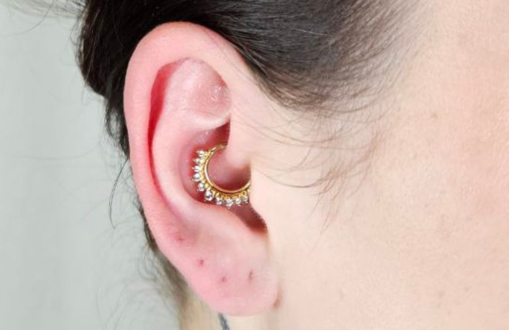 migrene-akupunktur-piercing-daith-drammen